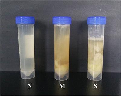 Expression Pattern of Cathelicidins in Dairy Cows During Endometritis and Role of Bovine Endometrial Epithelial Cells in Production of Cathelicidins